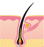 antichute